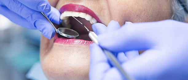 Best Dental Abscess Treatment in Grabill, IN